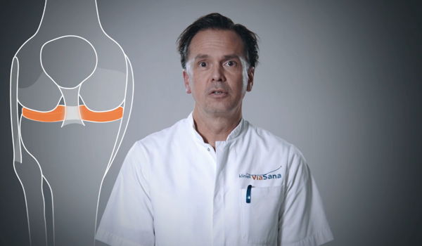 Waarom wordt de meniscus gehecht?