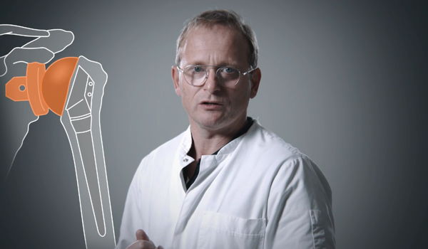 Welke schouderprotheses zijn er?