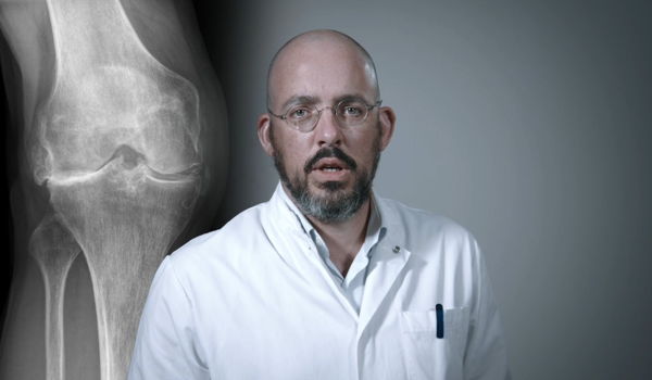 Waarom kiezen voor een knieprothese?