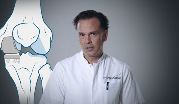 Wat is de duur van een knieprothese?