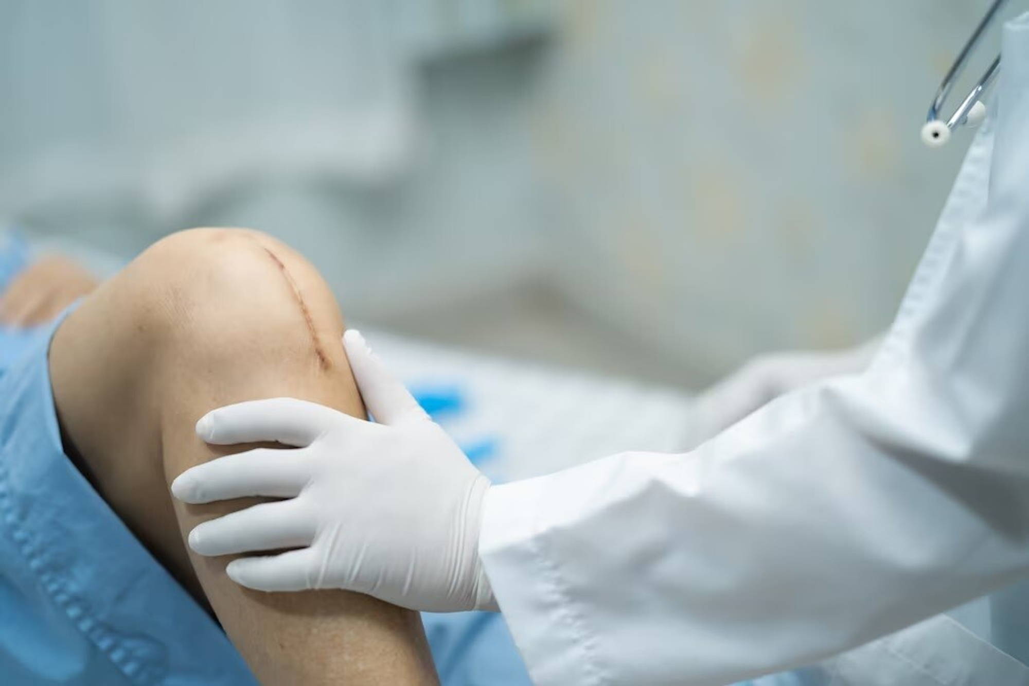 ASK studie: Patiëntervaring met doorbewegen na knieprothese